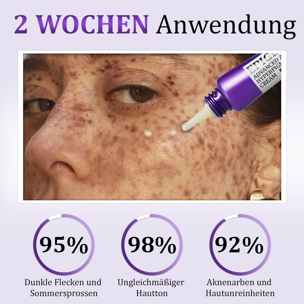 Furzero® EPIGLOW MelanEX Fortschrittliche Anti-Hyperpigmentierungscreme