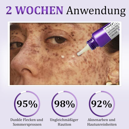Furzero® EPIGLOW MelanEX Fortschrittliche Anti-Hyperpigmentierungscreme