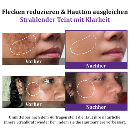 Furzero® EPIGLOW MelanEX Fortschrittliche Anti-Hyperpigmentierungscreme